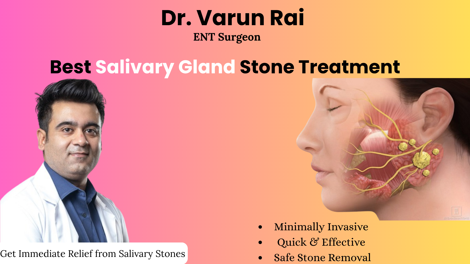 Best Salivary Gland Stone Treatment