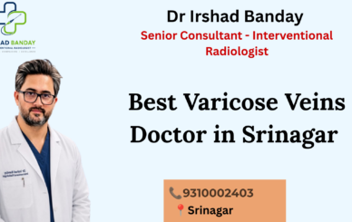 Best Varicose Veins Doctor in Srinagar