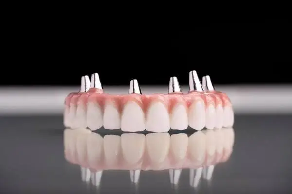 Implant-Supported Tooth Replacement