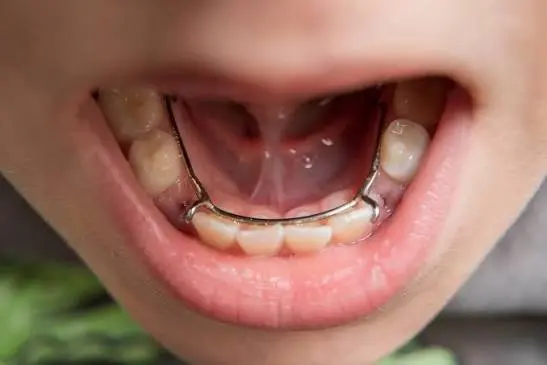 Interceptive & Early Orthodontic Treatment