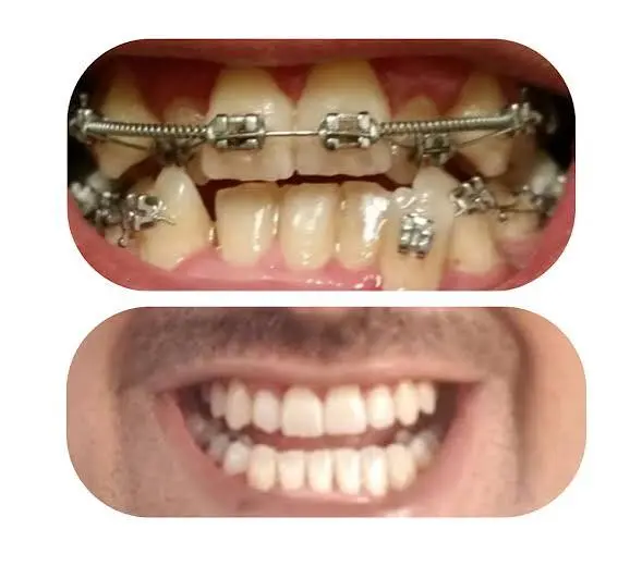 Orthodontics & Bite Correction
