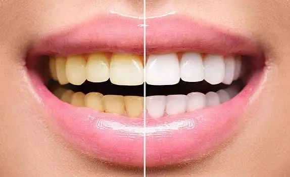 Cosmetic & Smile Dentistry