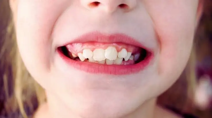 Early Orthodontic Assessment