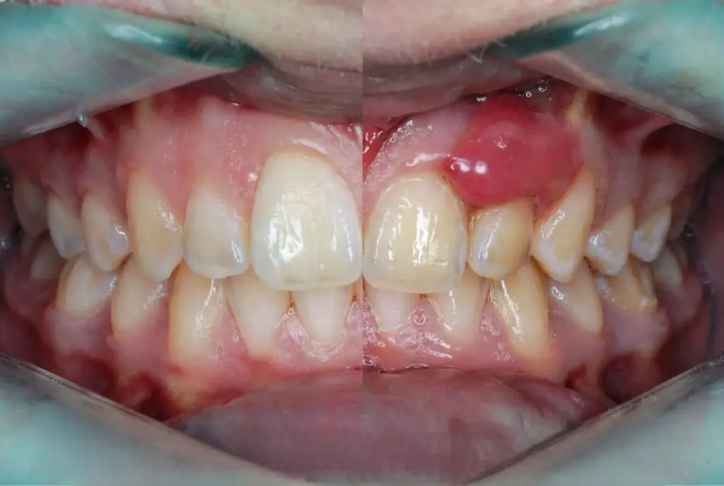 Gum & Periodontal Care